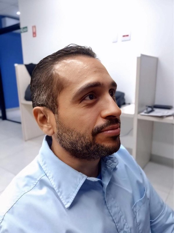 Antes - Roberto S.